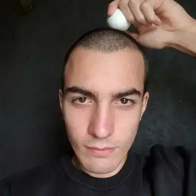 EGG CRACK AT EVERY 10K MC